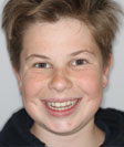 Caspar