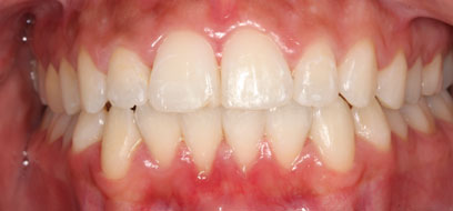 Before & Afters