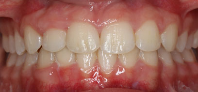 Before & Afters