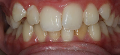 Before & Afters