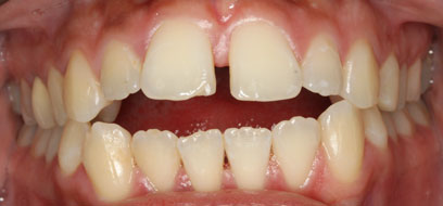 Before & Afters