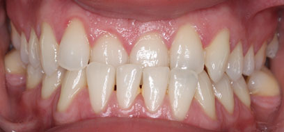 Before & Afters