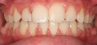 Before & Afters