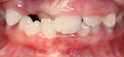 Before & Afters