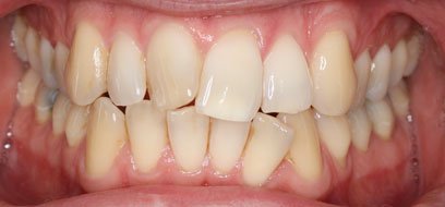 Before & Afters